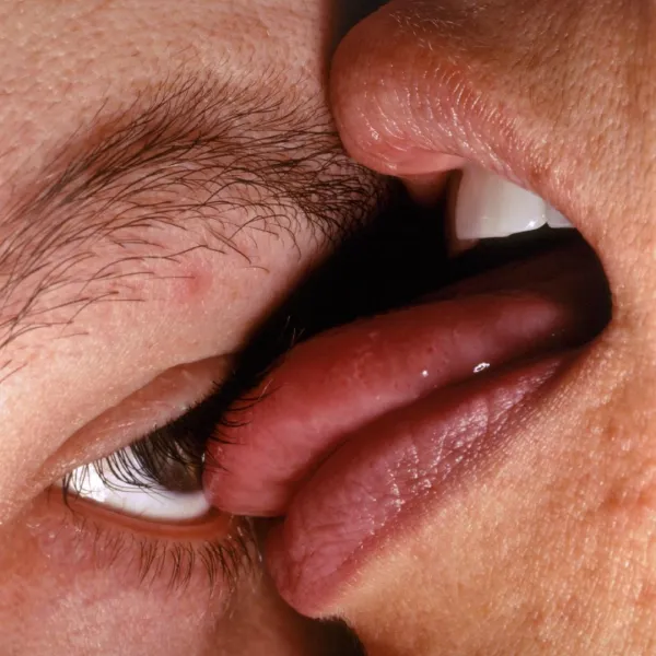 image of a tongue on an eyeball